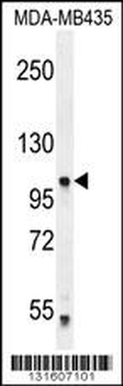 PCDHA5 Antibody (Center)