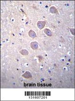 PCDHA5 Antibody (Center)