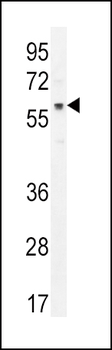 AKT1 Antibody (C-term T450)
