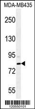 SMYD4 Antibody (C-term)