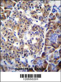 SMYD4 Antibody (C-term)