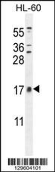 CNIH2 Antibody (N-term)