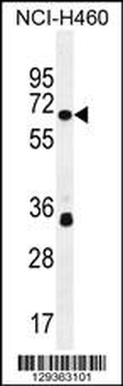 ZNF433 Antibody (N-term)