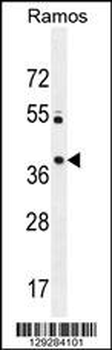 MGC24975 Antibody (C-term)