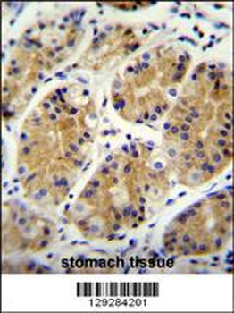 MGC24975 Antibody (C-term)