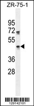 ZNF578 Antibody (C-term)