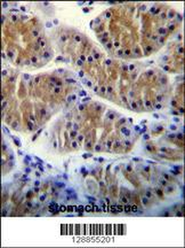 ANKRD5 Antibody (C-term)