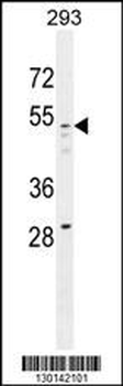 GOG8A Antibody (N-term)