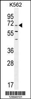 CPSF3L Antibody (N-term)
