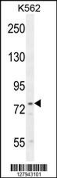 UROC1 Antibody (Center)