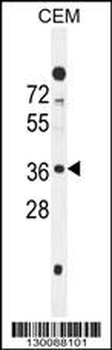 SFR1 Antibody (N-term)