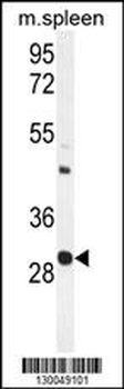 USF1 Antibody (Center)
