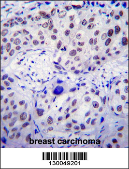 USF1 Antibody (Center)