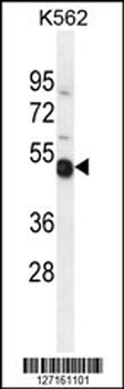 TXNDC6 Antibody (Center)