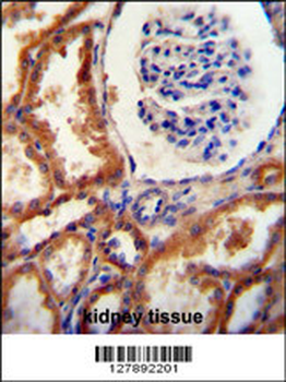 DNAJC22 Antibody (C-term)