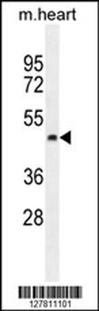 PTCD2 Antibody (Center)