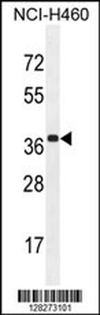 ZC3H15 Antibody (C-term)