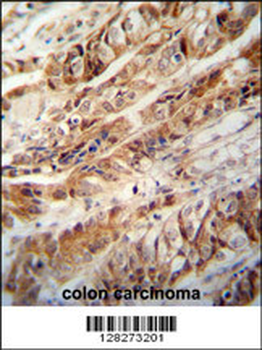 ZC3H15 Antibody (C-term)