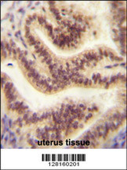 CP045 Antibody (Center)