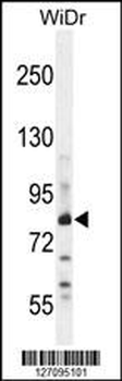 ZN180 Antibody (N-term)