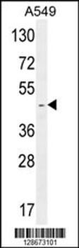 RBMX2 Antibody (C-term)