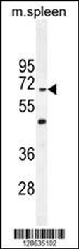 CCDC9 Antibody (N-term)