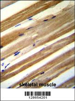 CU070 Antibody (C-term)