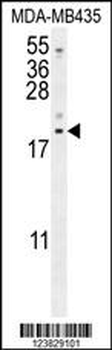 LYRM4 Antibody (Center)