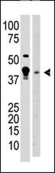 MBD2 antibody