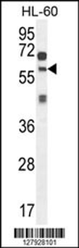 ZSWIM1 Antibody (C-term)