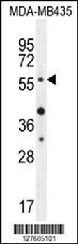 AKT1 (Thr308) Antibody