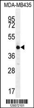 ALX4 Antibody (Center)
