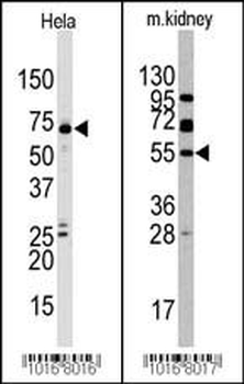 JMJD4 Antibody (C-term)