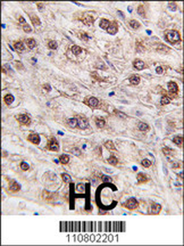 JMJD4 Antibody (C-term)
