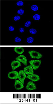 CITED2 Antibody (C-term)