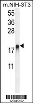 ARL8A Antibody (Center)