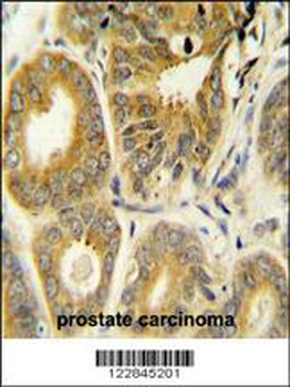 ARL8A Antibody (Center)