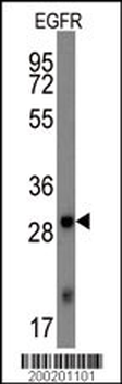 EGFR Antibody (Ascites)