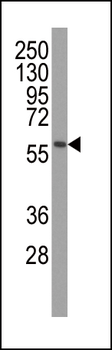PINK1 Antibody (Ascites)