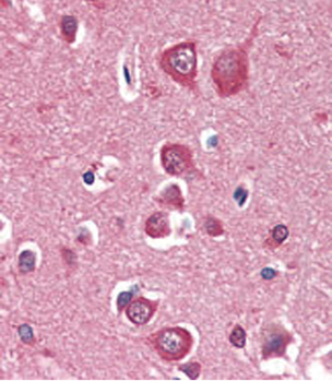 PINK1 Antibody (Ascites)