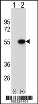 Reptin/TIP49B/RUVB2 Antibody (C-term)