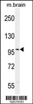 Androgen Receptor (ANDR) Antibody