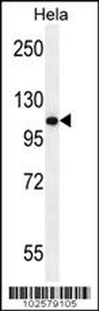 Androgen Receptor (ANDR) Antibody