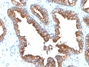 Cytokeratin 8/18 Antibody