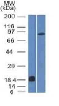 Anti-E-Cadherin / CD324 Antibody