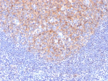 CD81 / TAPA-1 Antibody