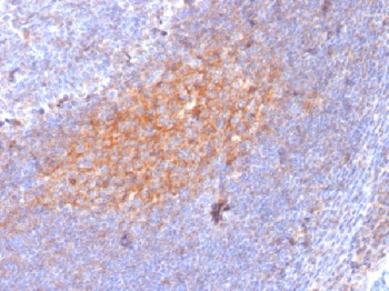 CD81 / TAPA-1 Antibody