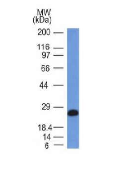 CD79a Antibody