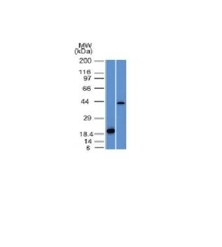Aurora B Antibody