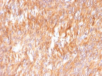 Calnexin Antibody
